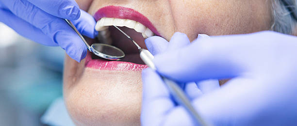 Best Broken or Chipped Tooth Repair in Black River, NY